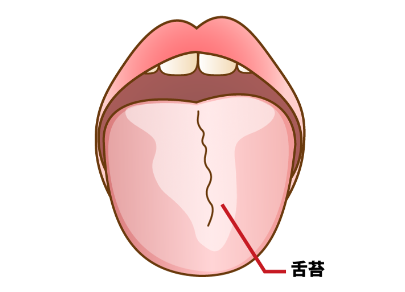 舌苔｜やくし歯科