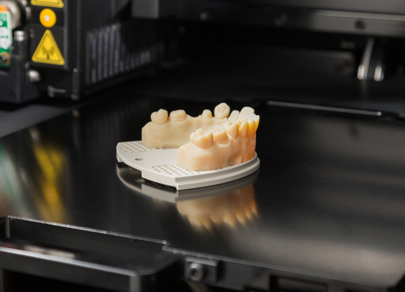 3Dプリンターで手術の「リハーサル」|やくし歯科